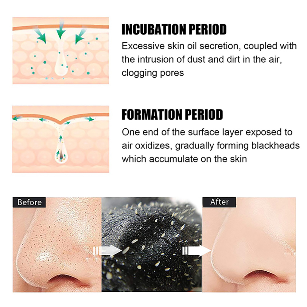 10-100개 블랙헤드 제거 마스크 코팩 블랙헤드 코  - Nasal Aspirator 리뷰 및 가격